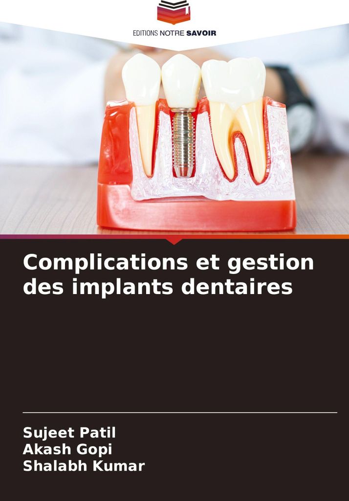 Complications et gestion des implants dentaires