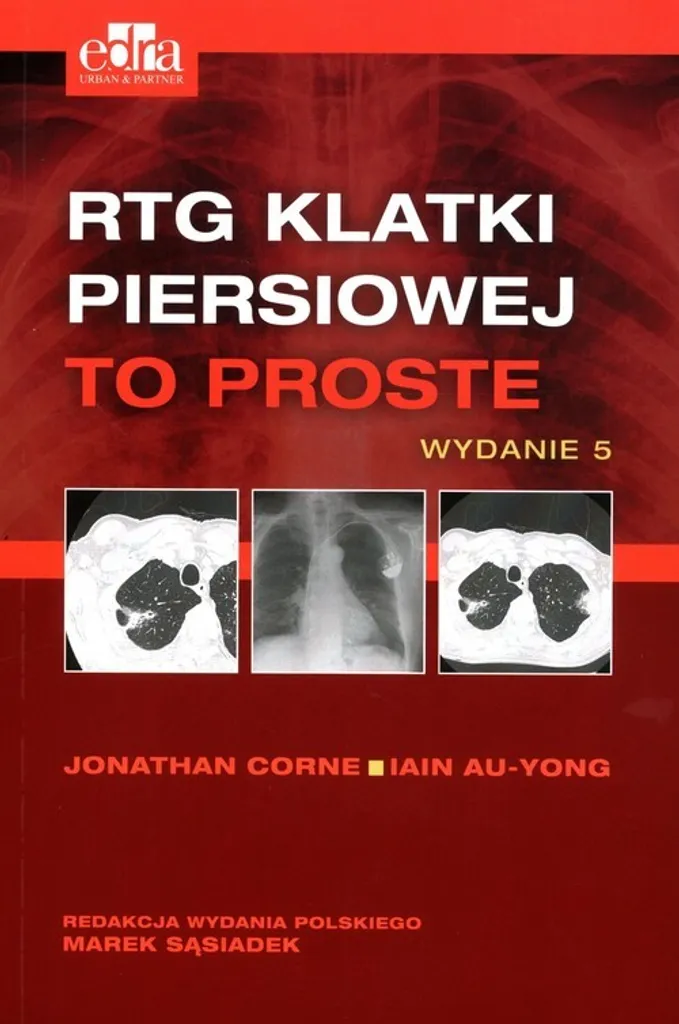 Radiographie du thorax C'est facile - Guide I Au-Jong et J. Corne Polonais