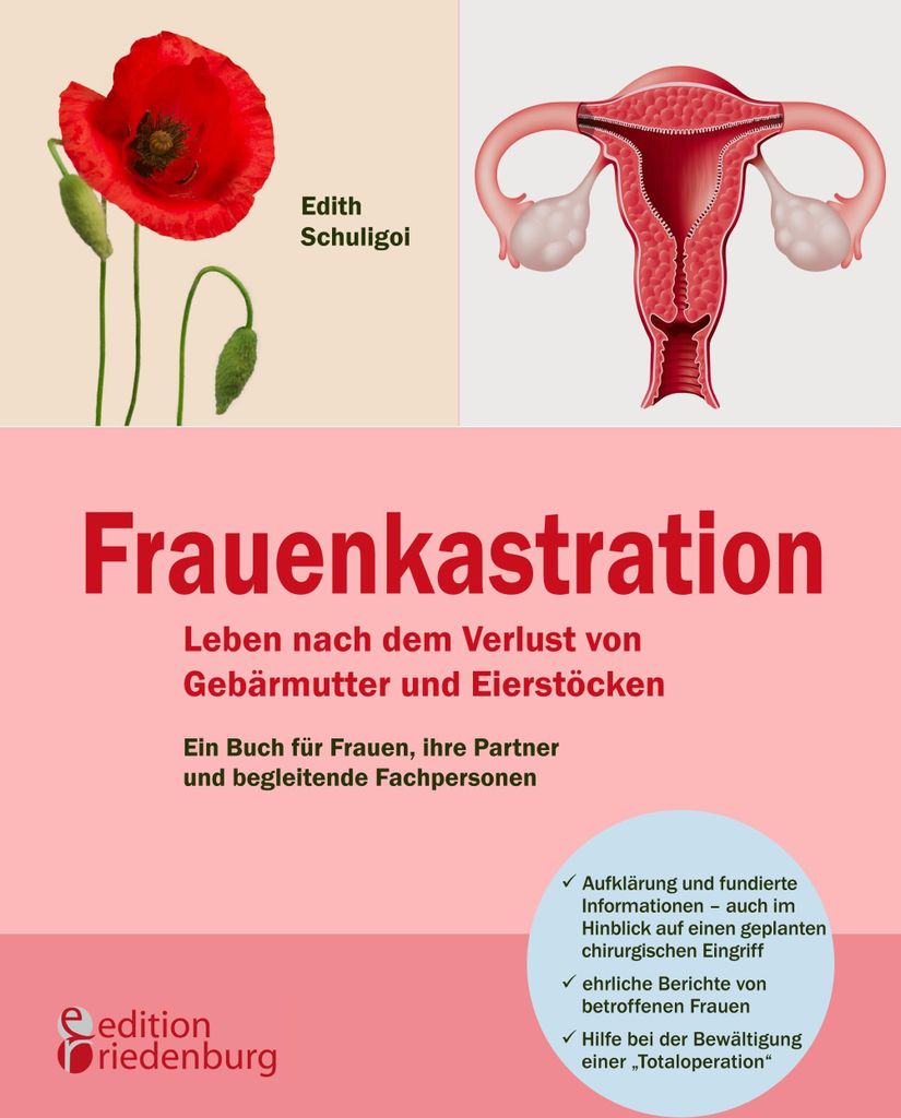 Frauenkastration - Leben nach dem Verlust von Gebärmutter und Eierstöcken: Ein Buch für Frauen, ihre Partner und begleitende Fachpersonen