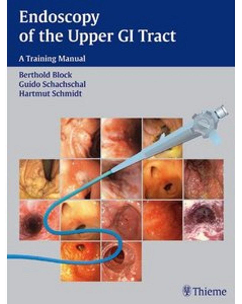 Endoscopy of the Upper GI Tract