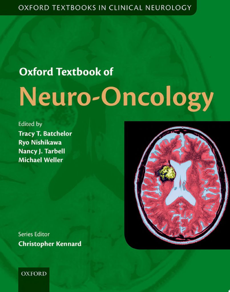 Oxford Lehrbuch der Neuro-Onkologie