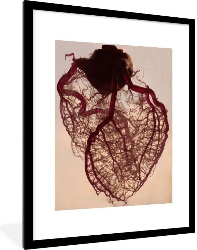 MuchoWow Gerahmtes Poster Anatomisches Herz 60x80 cm - Poster mit Schwarzem Bilderrahmen Wandposter Rahmen Foto Bilder - Wohnzimmer - Dekoratione...