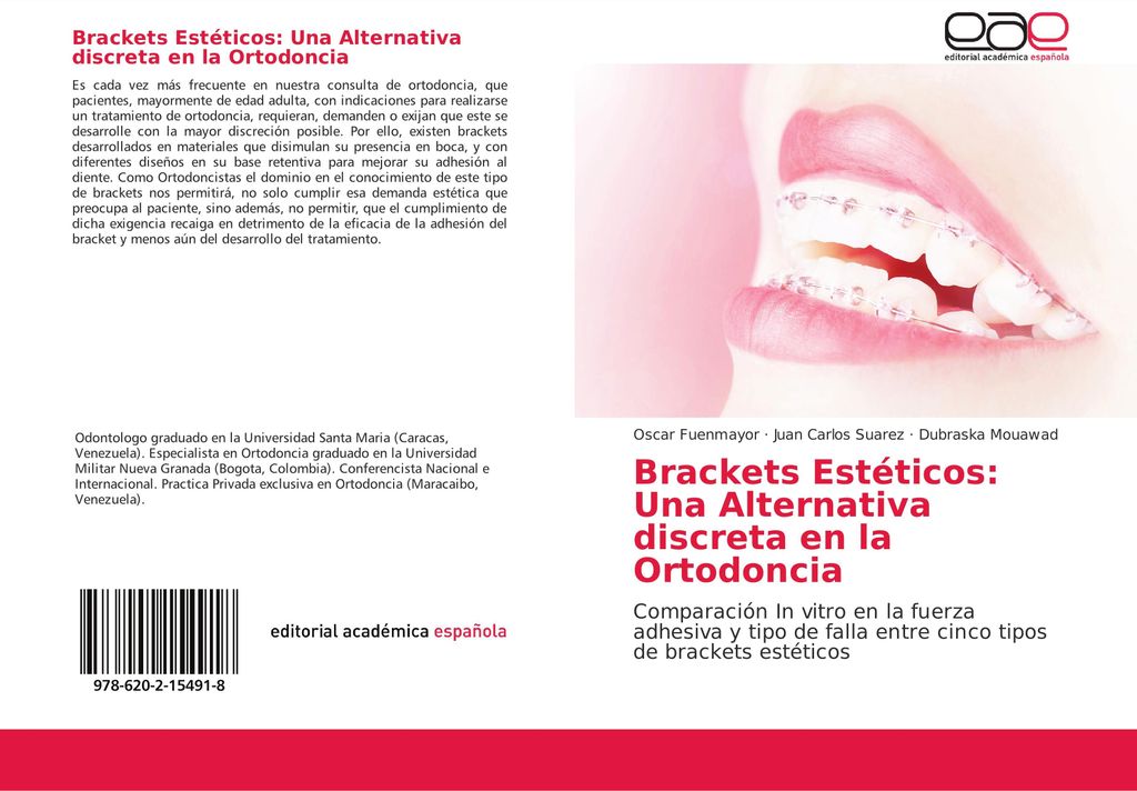 Brackets Estéticos: Una Alternativa discreta en la Ortodoncia