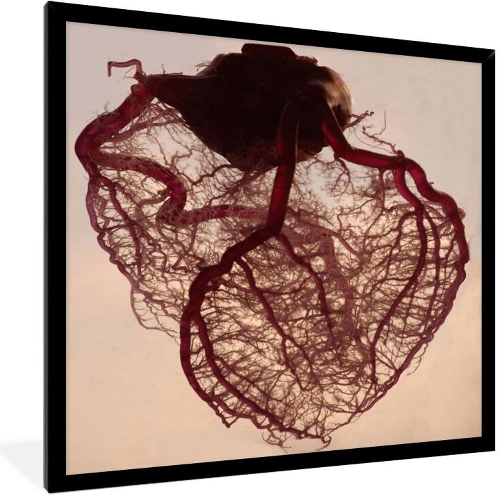 MuchoWow Gerahmtes Poster Anatomisches Herz 30x40 cm - Poster mit Schwarzem Bilderrahmen Wandposter Rahmen Foto Bilder - Wanddeko - Kunstdrucke