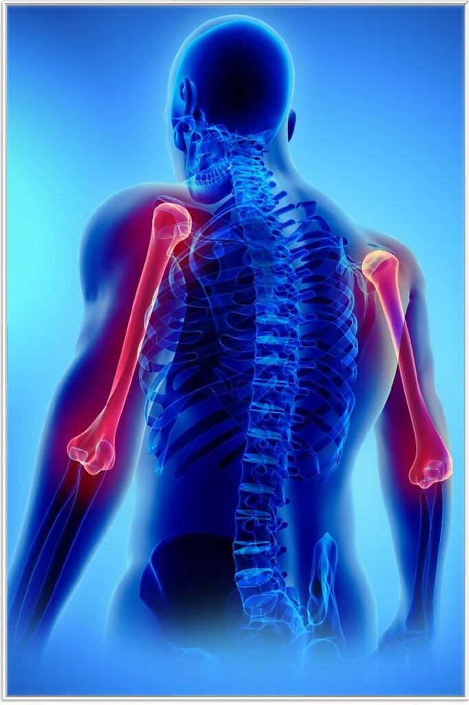 Wallario Wandbild Anatomie Mensch Oberarmknochen, Größe: 61 x 91,50 cm, Poster mit weißem Aluminiumrahmen