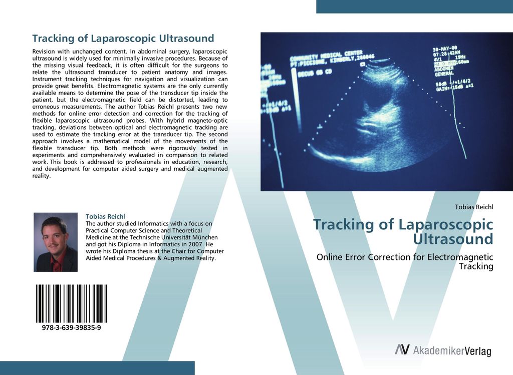 Tracking of Laparoscopic Ultrasound