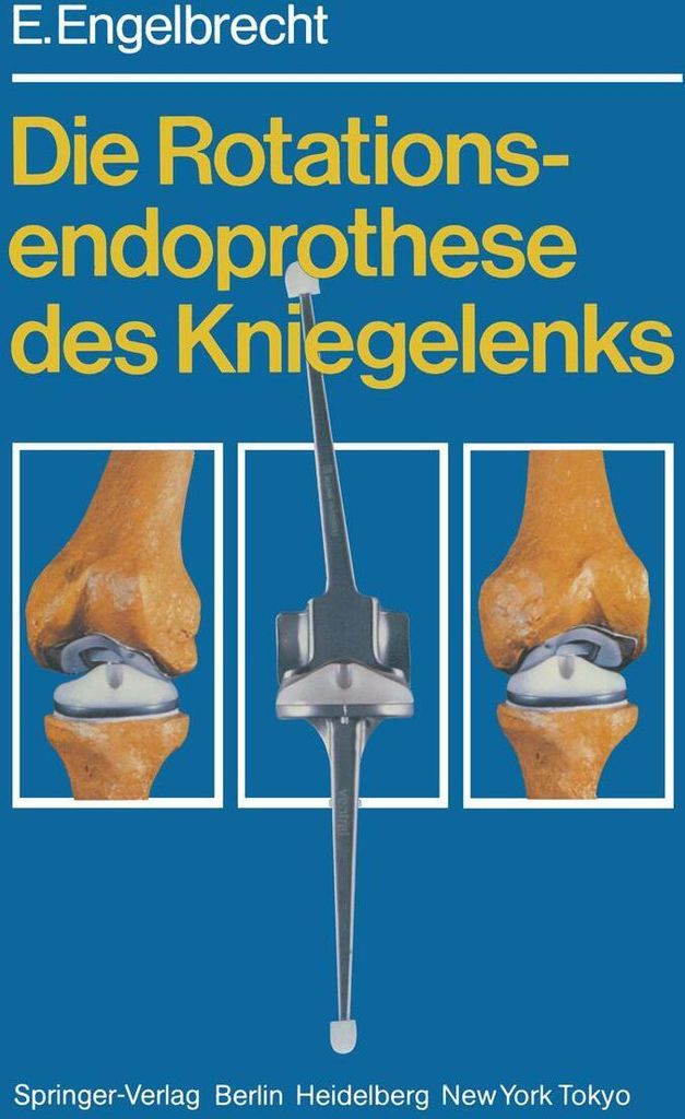 Die Rotationsendoprothese des Kniegelenks
