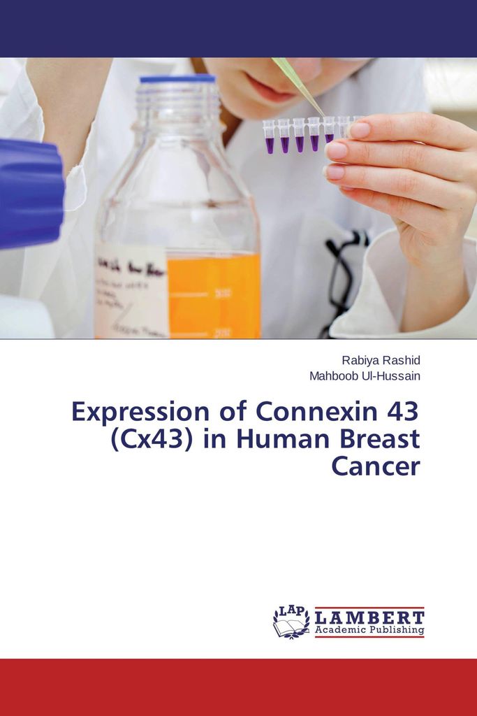 Expression of Connexin 43 (Cx43) in Human Breast Cancer