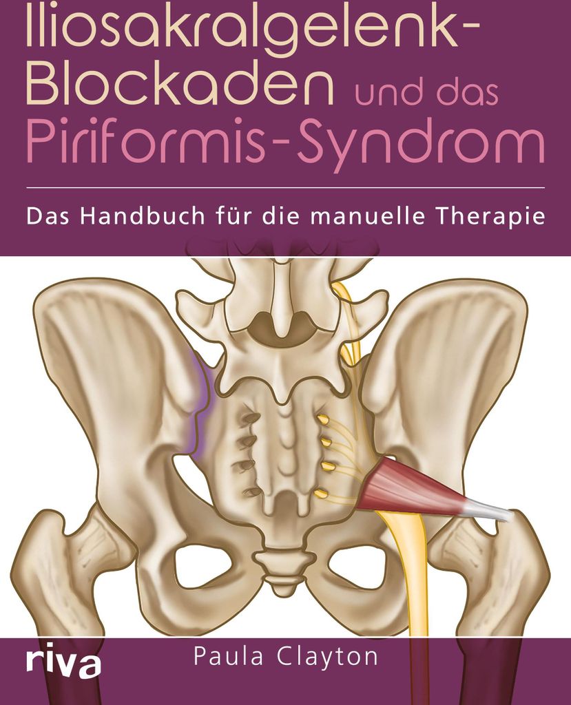 Iliosakralgelenk-Blockaden und das Piriformis-Syndrom