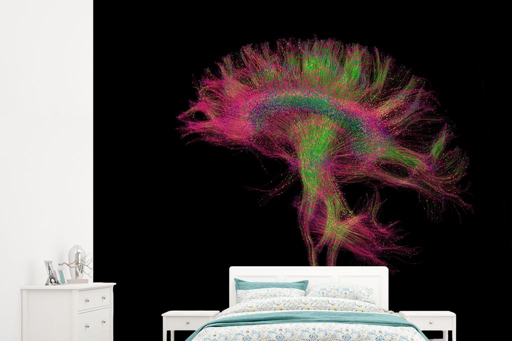 MuchoWow Fototapete für Wohnzimmer oder Schlafzimmer Wandtapete Vinyl Motivtapete MRI-Scan - 265x240 cm - Zimmer für Kinder
