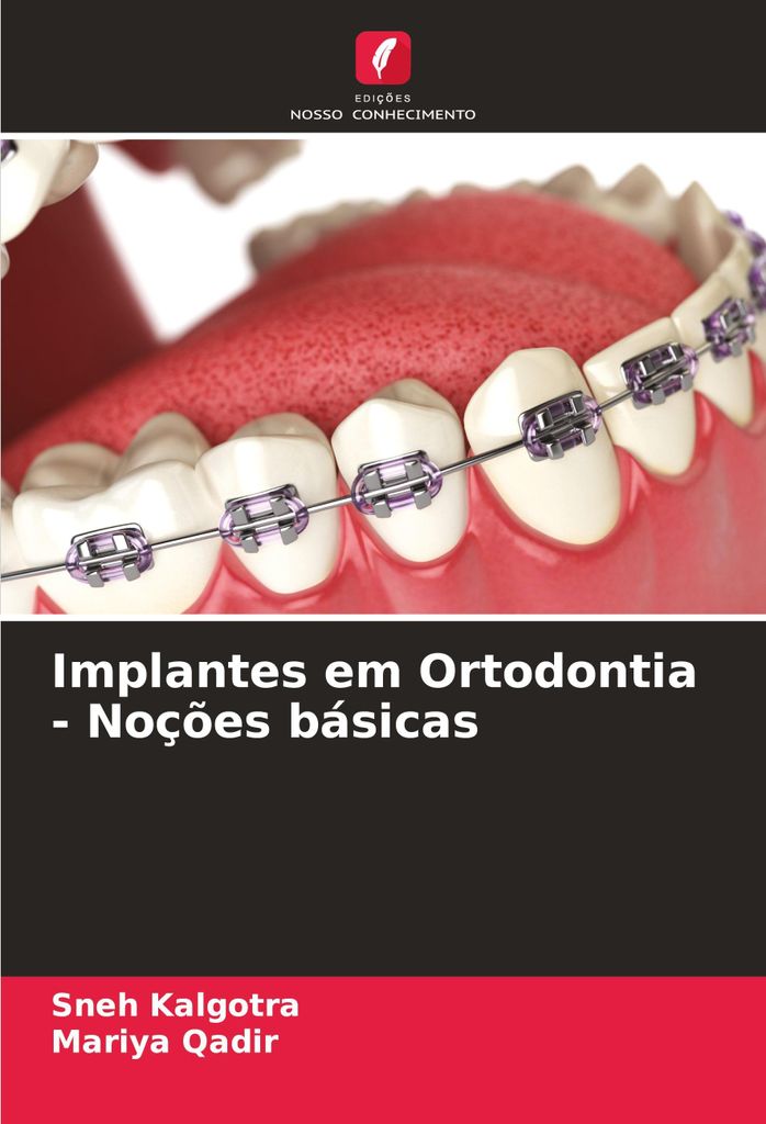 Implantes em Ortodontia - Noções básicas