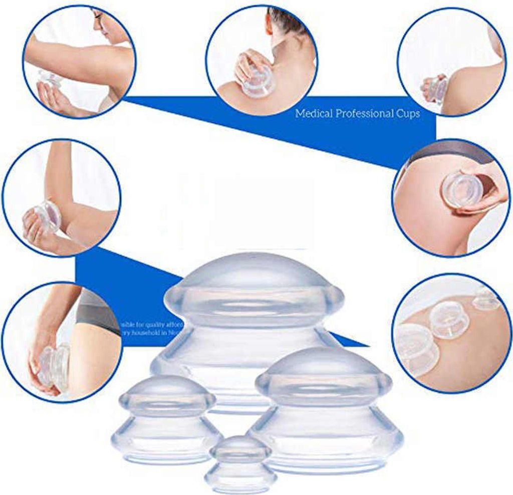 INF Schröpfköpfe für Ganzkörpermassage 4er Pack (L-XS) Weiß Produktbild 
