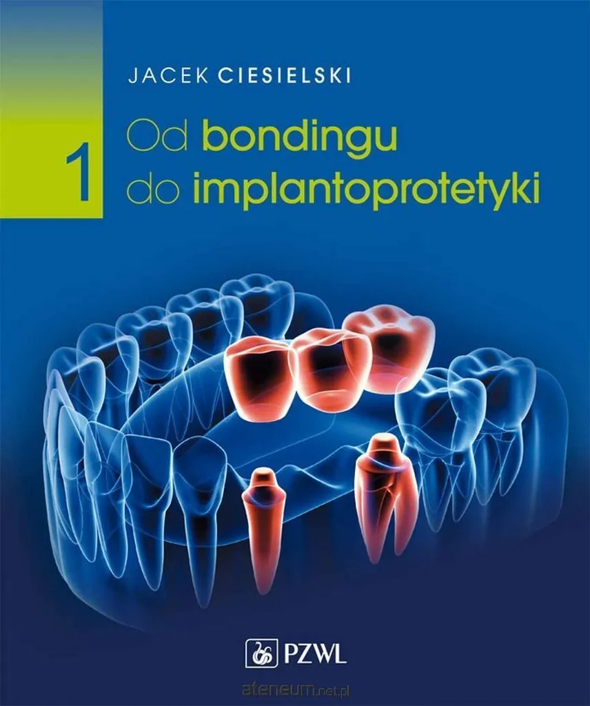 Du collage à l'implantoprothèse Jacek Ciesielski Vol.1 Édition Polonaise