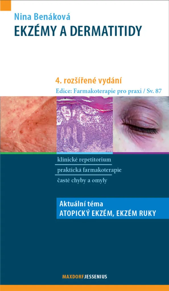 Livre Eczéma et Dermatite par Nina Benáková Guide Médical Format Broché