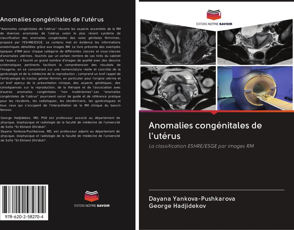 Anomalies congénitales de l'utérus