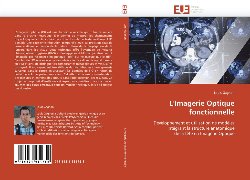 L'Imagerie Optique fonctionnelle