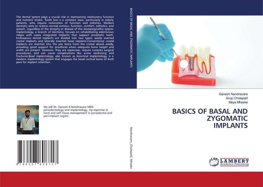 Basics Of Basal And Zygomatic Implants