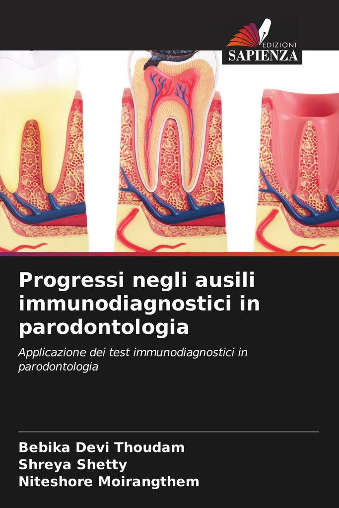 Progressi negli ausili immunodiagnostici in parodontologia