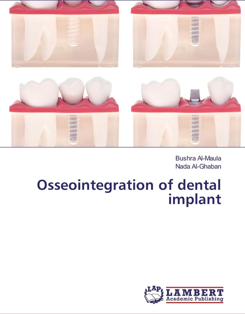 Osseointegration of dental implant