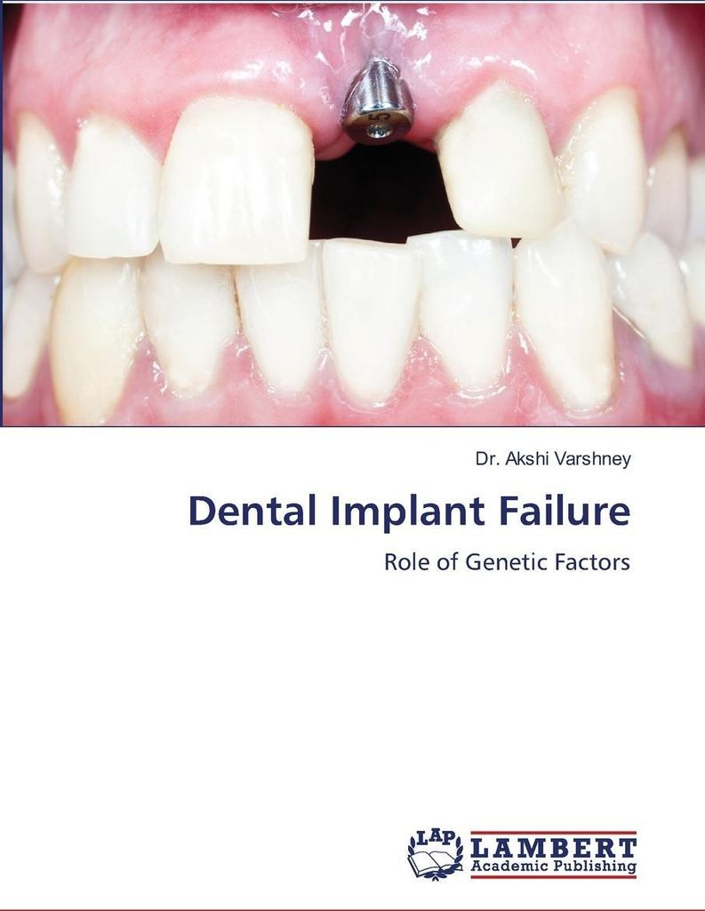 Dental Implant Failure
