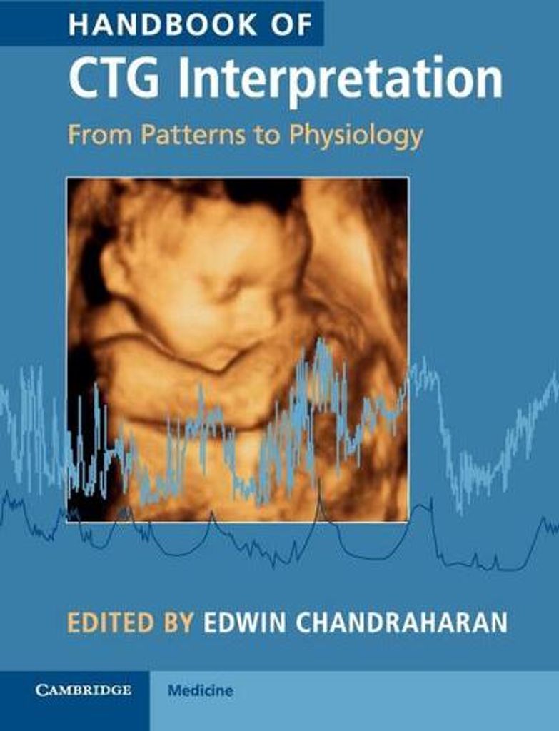 Handbook of CTG Interpretation