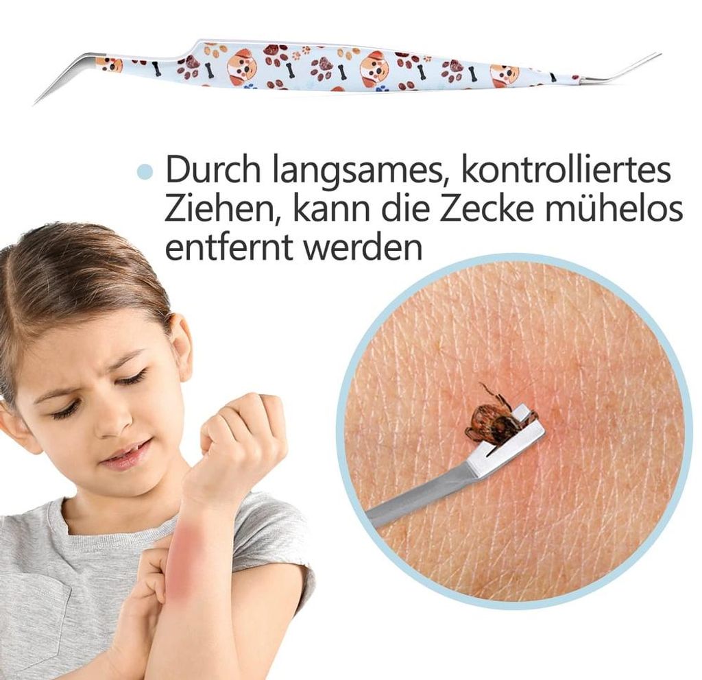 Helperfect 2-in-1 Profi Zeckenzange - für Hunde und Katzen - Hellblau