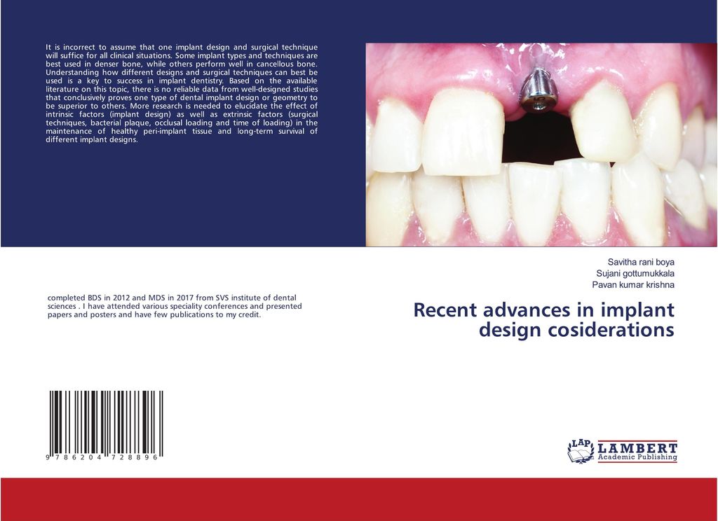Recent advances in implant design cosiderations