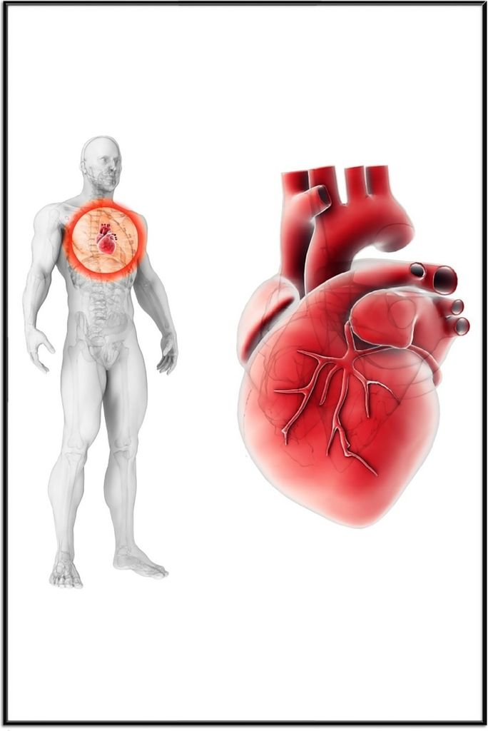 Wallario Wandbild Anatomie des Menschen Herz in Nahansicht, Größe: 61 x 91,50 cm, Poster mit schwarzem Aluminiumrahmen