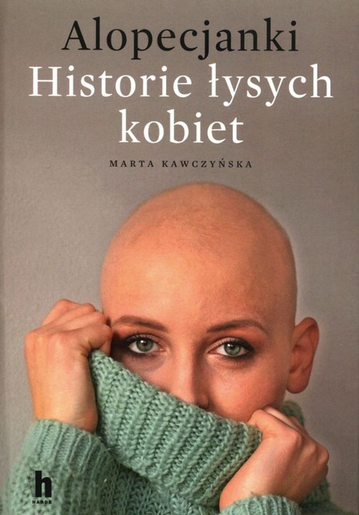 Alopecjanki Historie ³ysych kobiet Marta Krawczyñska (Buch auf Polnisch)
