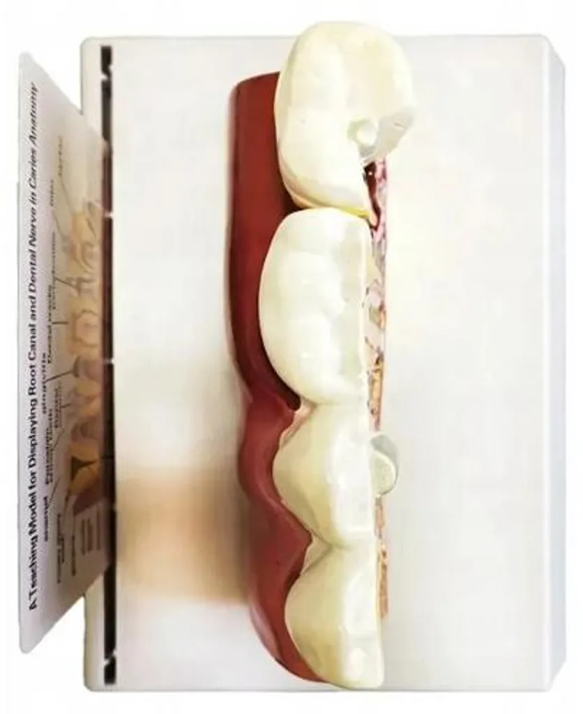 Comprendre les Soins avec le Modèle Anatomique de Dent 3D Verk 27614 - 9