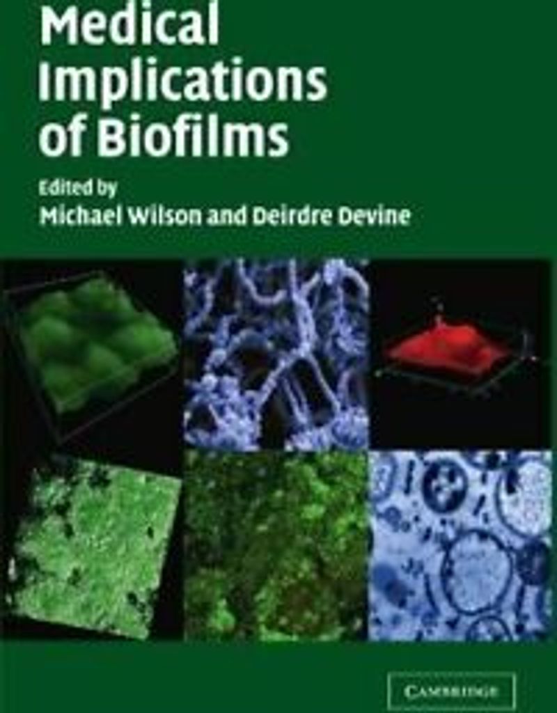 Medical Implications of Biofilms. Wilson, Michael .