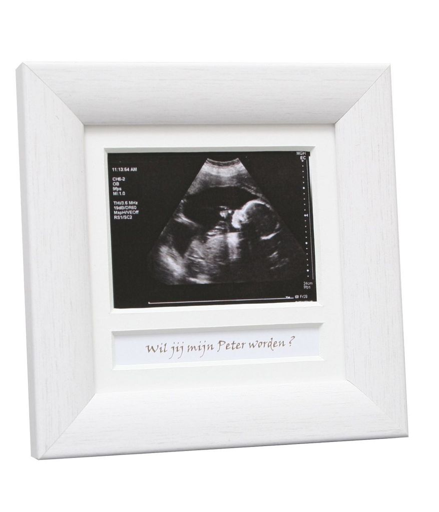 Deknudt Echographie Rahmen weiß 10x10 cm Englisch