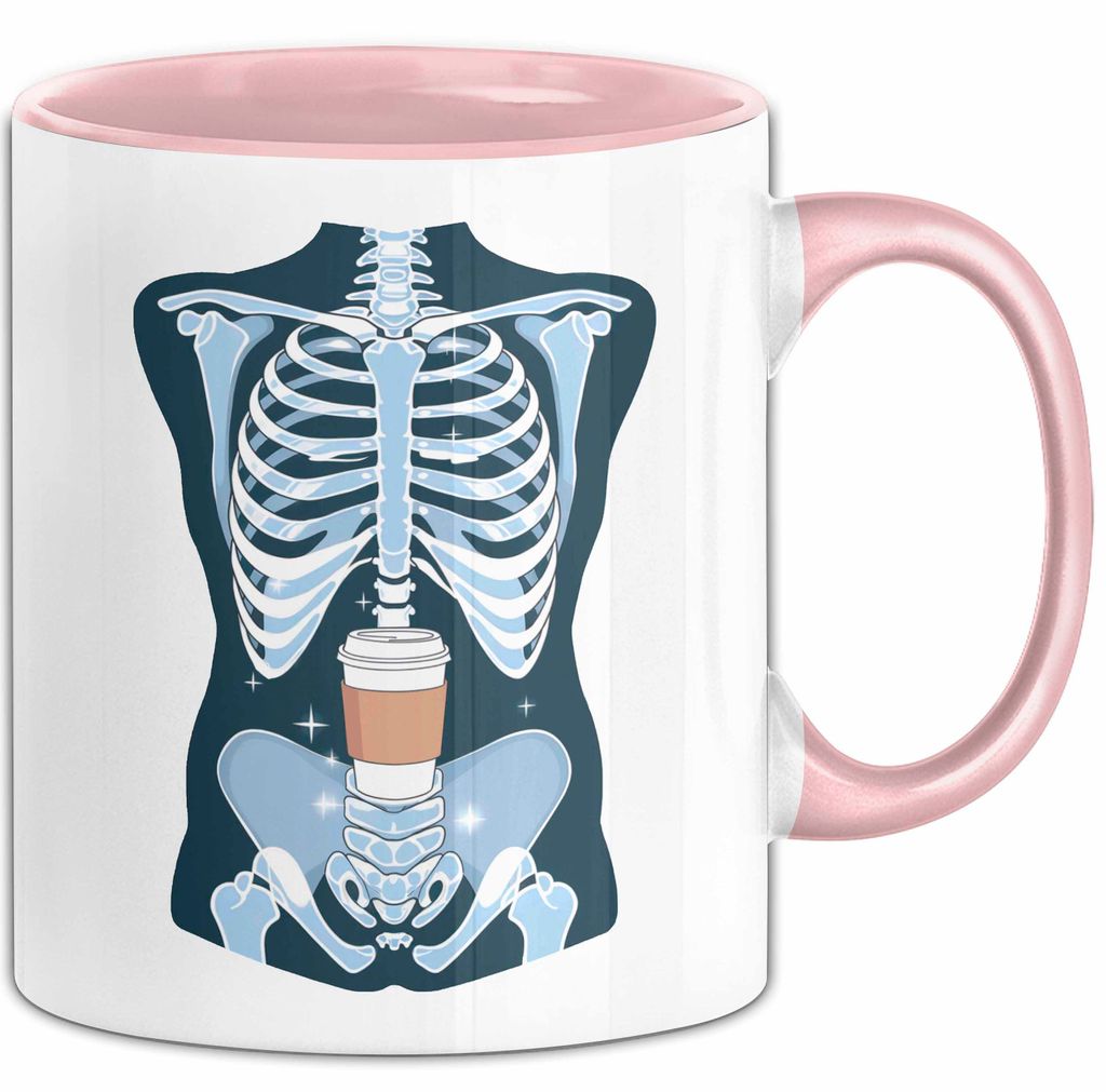 Radiologe Tasse Geschenk Lustige Geschenkidee Spruch Für Bildgebungs Profis (Rosa)