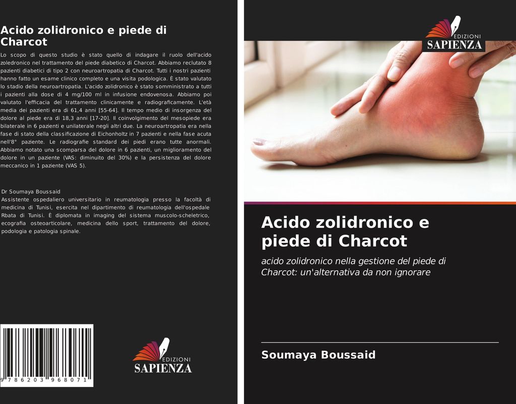 Acido zolidronico e piede di Charcot