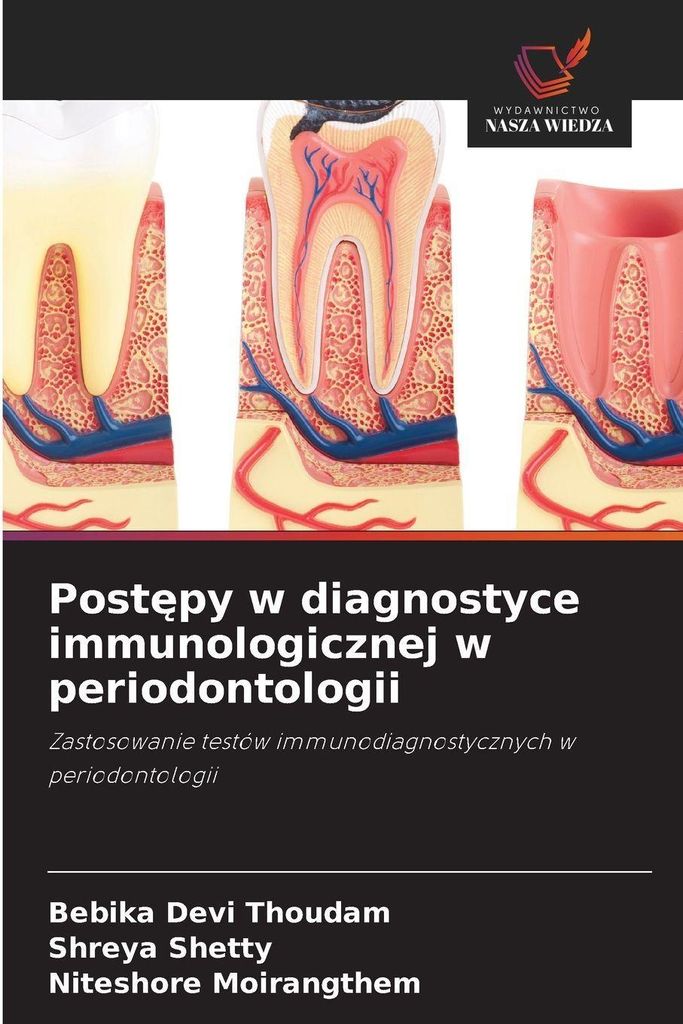 Post¿py w diagnostyce immunologicznej w periodontologii