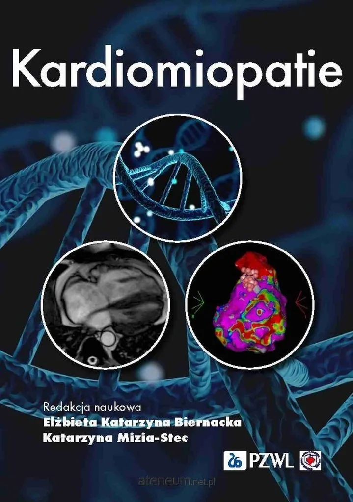 Cardiomyopathies : Guide Médical Complet sur les Maladies du Myocarde