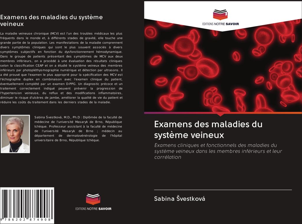 Examens des maladies du système veineux