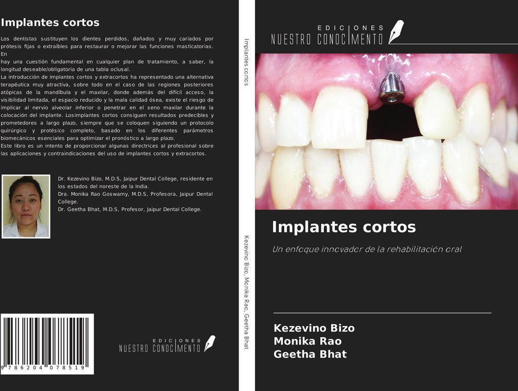 Implantes cortos