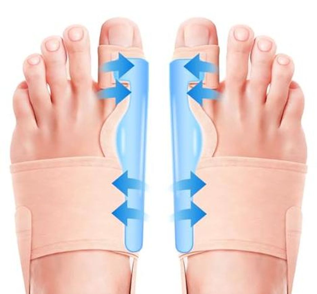 2x Hallux Valgus Korrektur Schiene - Zehenbegradigung für Produktbild 