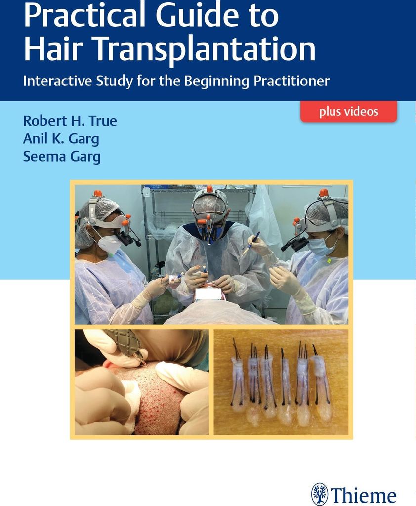 Practical Guide to Hair Transplantation