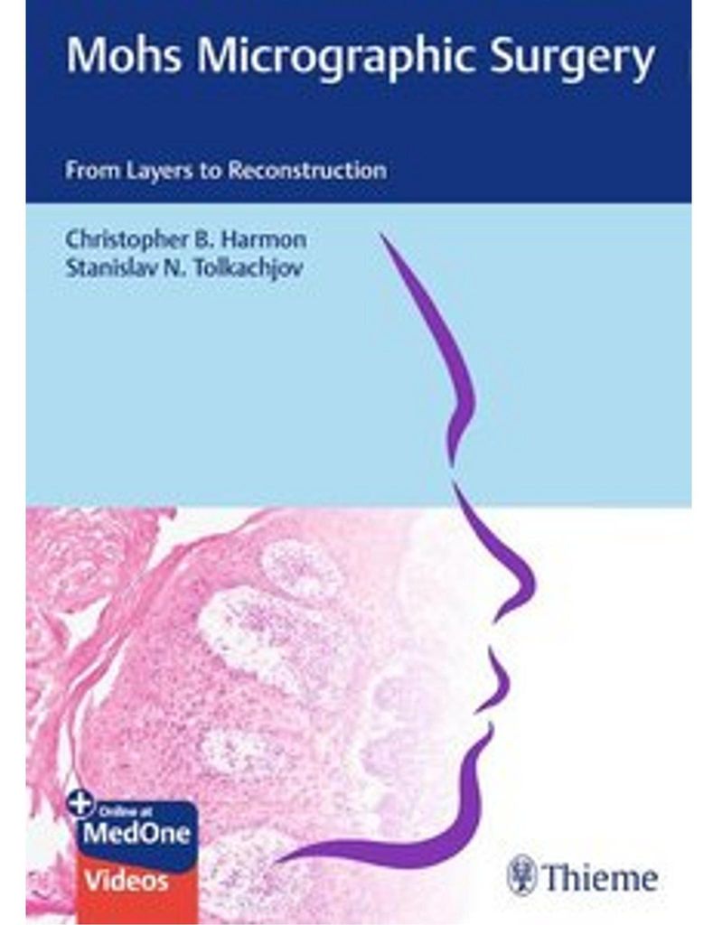 Mohs Micrographic Surgery: From Layers to Reconstruction