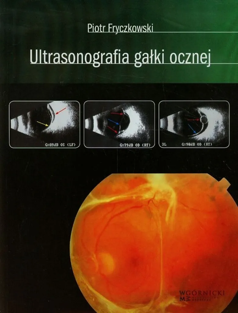 Ultrasonographie du globe oculaire : Guide pratique d'échographie 250p
