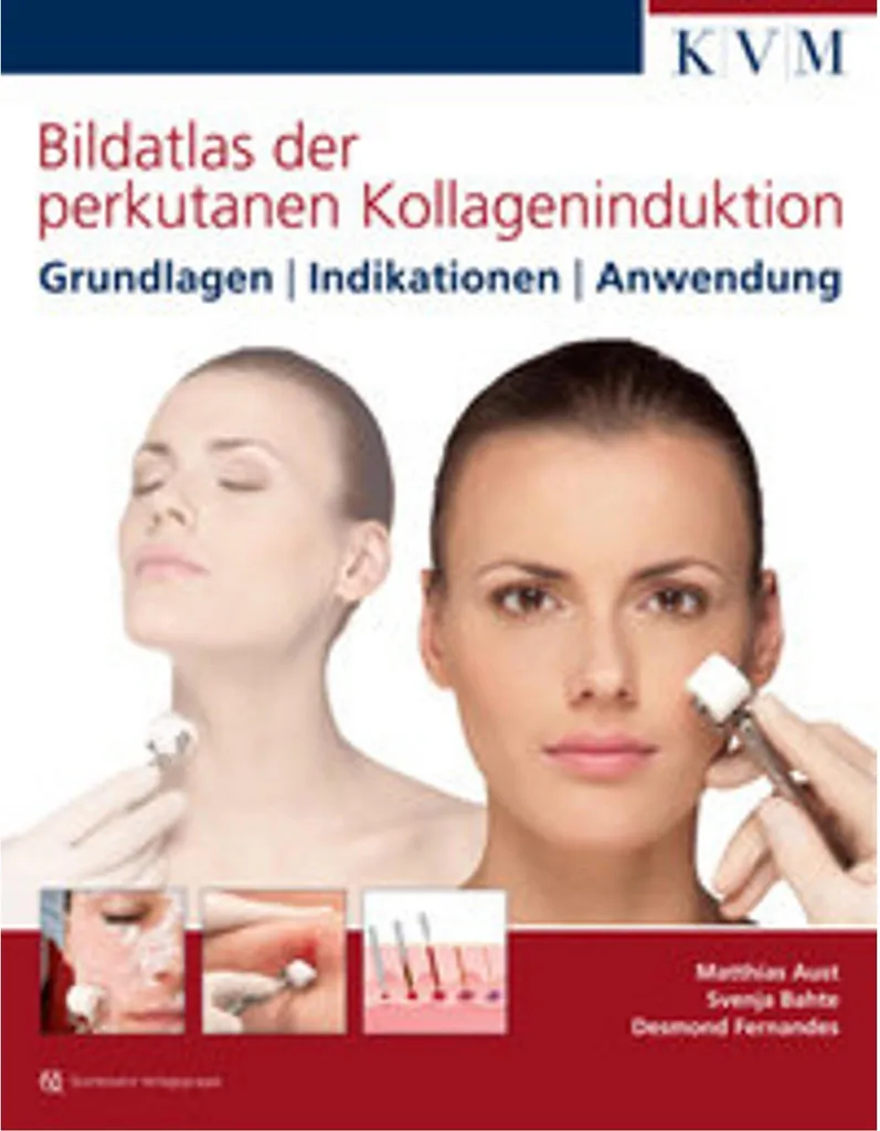 Bildatlas der perkutanen Kollageninduktion Manuel Microneedling
