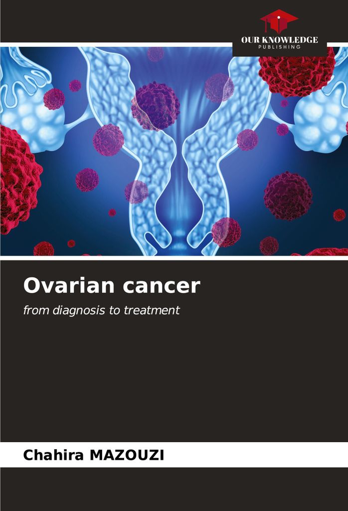 Ovarian cancer