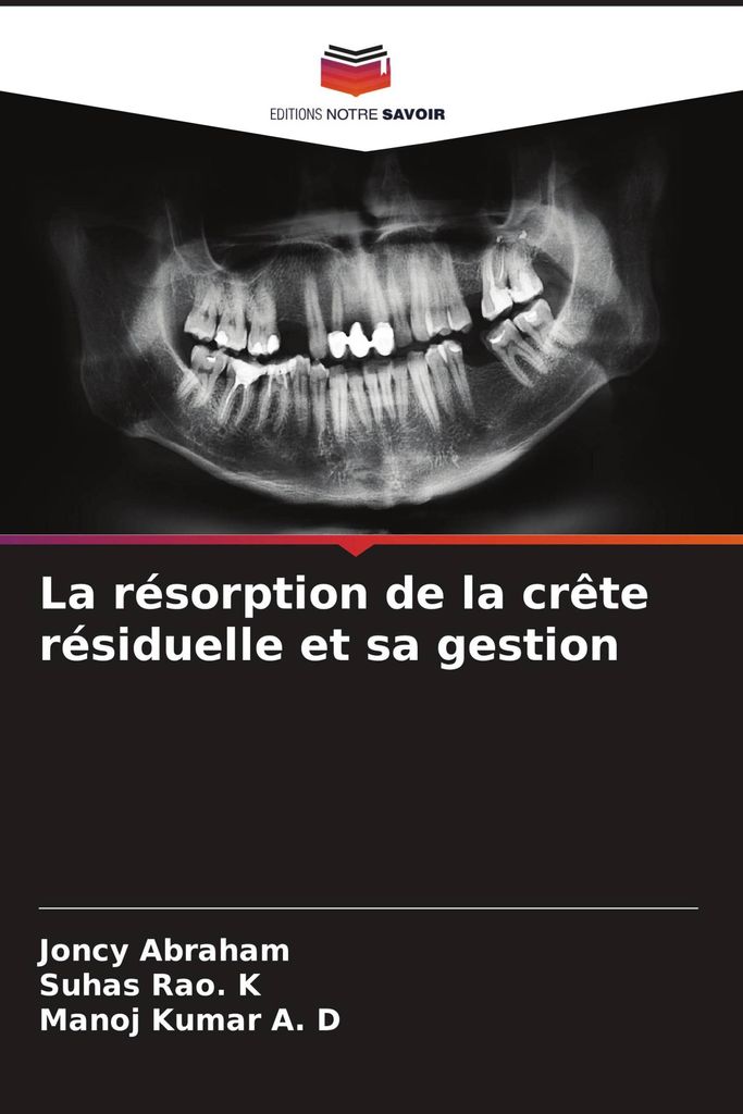 La résorption de la crête résiduelle et sa gestion