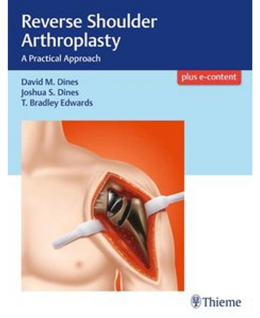 Reverse Shoulder Arthroplasty