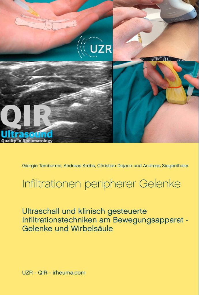 Infiltrationen peripherer Gelenke