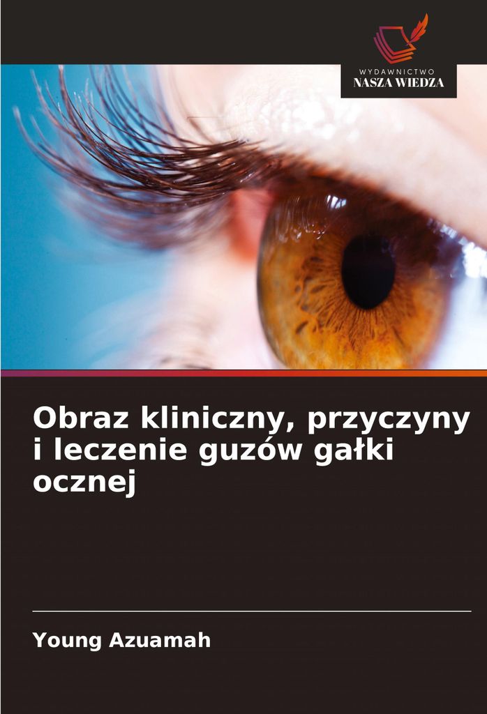 Obraz kliniczny, przyczyny i leczenie guzów ga¿ki ocznej
