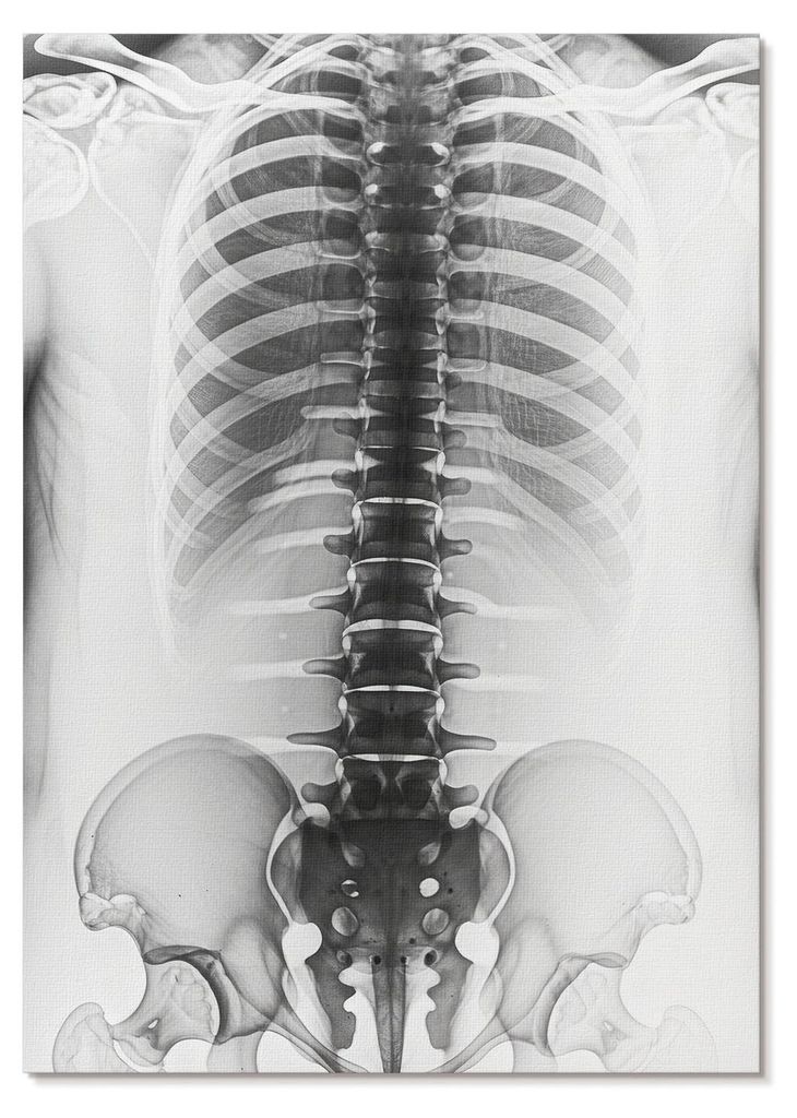 POSTER - 29x42 cm (A3) - Soft Structure - Skelett in Schwarzweiß - Wandbild für Wohnzimmer Schlafzimmer & Flur, Modernes Poster Wanddeko, Ungerahmt
