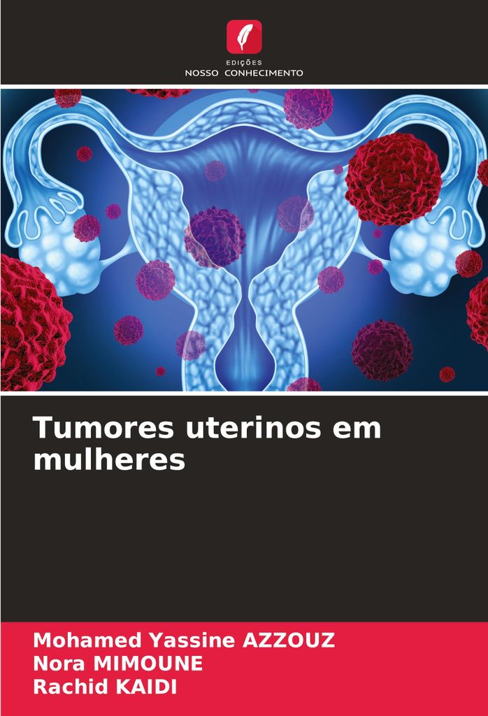 Tumores uterinos em mulheres